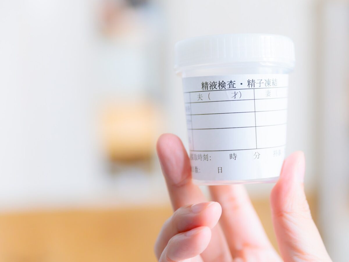 精液検査