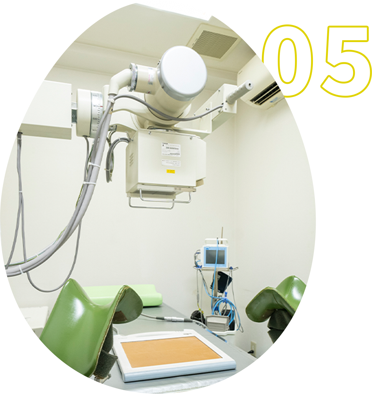 痛みや不安を軽減した卵管造影検査